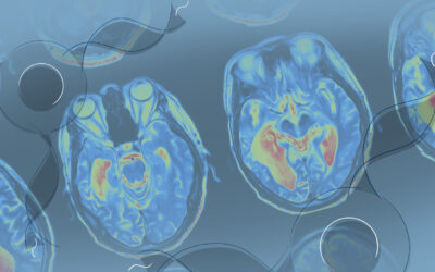 A Dopamine Environment